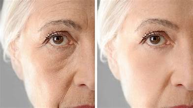 Anti Aging
