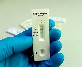 Same-Day Herpes Test and STD Dermatology Treatments in Dubai