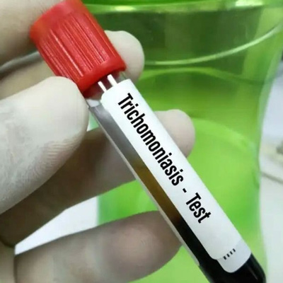 Confidential Trichomoniasis Test in Dubai at Cosmocare Medical Center